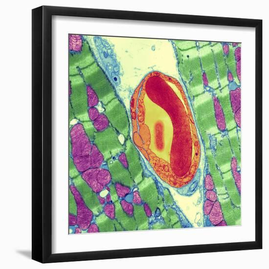 Cardiac Muscle And Capillary, TEM-Thomas Deerinck-Framed Premium Photographic Print