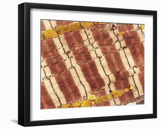 Cardiac Muscle, TEM-Thomas Deerinck-Framed Photographic Print