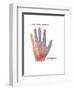 Carpal Tunnel Syndrome, Illustration-Gwen Shockey-Framed Art Print