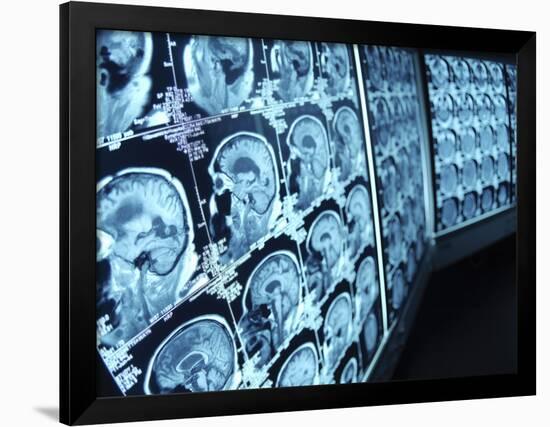 Cat Scan Images of Brain-null-Framed Photographic Print