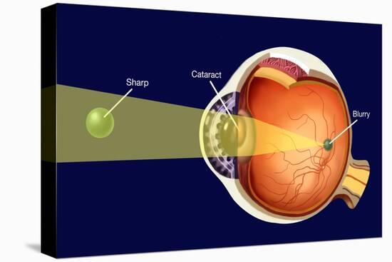 Cataract-Spencer Sutton-Stretched Canvas