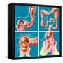 Causes of Constipation-John Bavosi-Framed Stretched Canvas