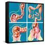 Causes of Constipation-John Bavosi-Framed Stretched Canvas