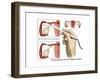 Cauterization of the Fallopian Tubes-Gwen Shockey-Framed Art Print