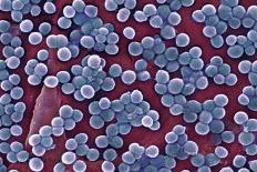 MRSA Bacteria, SEM-CDC-Framed Photographic Print