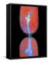 Cell Division In Salmonella Bacterium-Dr. Kari Lounatmaa-Framed Stretched Canvas