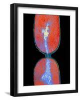 Cell Division In Salmonella Bacterium-Dr. Kari Lounatmaa-Framed Photographic Print