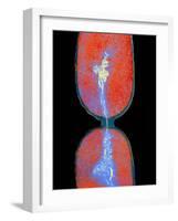 Cell Division In Salmonella Bacterium-Dr. Kari Lounatmaa-Framed Photographic Print