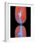 Cell Division In Salmonella Bacterium-Dr. Kari Lounatmaa-Framed Photographic Print