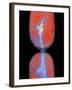 Cell Division In Salmonella Bacterium-Dr. Kari Lounatmaa-Framed Photographic Print