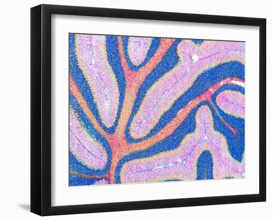 Cerebellum Structure, Light Micrograph-Thomas Deerinck-Framed Photographic Print