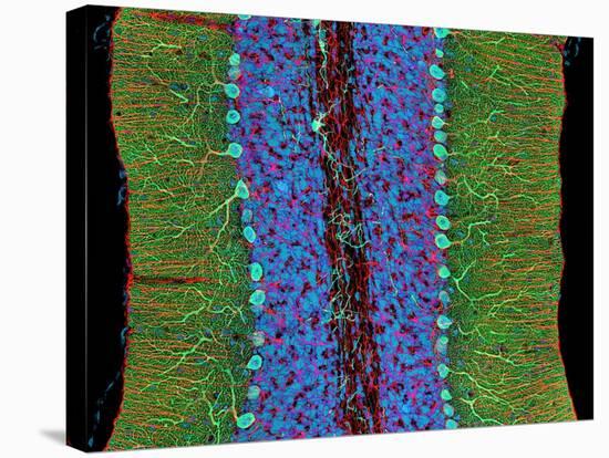 Cerebellum Tissue, Light Micrograph-Thomas Deerinck-Stretched Canvas