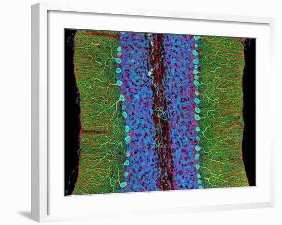 Cerebellum Tissue, Light Micrograph-Thomas Deerinck-Framed Photographic Print