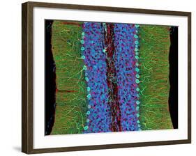 Cerebellum Tissue, Light Micrograph-Thomas Deerinck-Framed Photographic Print