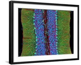 Cerebellum Tissue, Light Micrograph-Thomas Deerinck-Framed Photographic Print