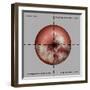 Cervical Cancer Progression, Illustration-Gwen Shockey-Framed Giclee Print