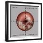 Cervical Cancer Progression, Illustration-Gwen Shockey-Framed Giclee Print