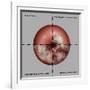 Cervical Cancer Progression, Illustration-Gwen Shockey-Framed Giclee Print