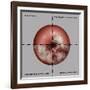 Cervical Cancer Progression, Illustration-Gwen Shockey-Framed Giclee Print