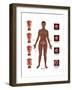 Cervical Cancer-Gwen Shockey-Framed Art Print