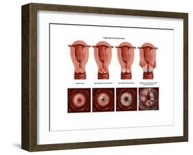 Cervical Cancer-Gwen Shockey-Framed Art Print