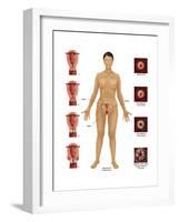 Cervical Cancer-Gwen Shockey-Framed Art Print