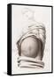 Cesarean Section, Incisions, Illustration, 1822-Science Source-Framed Stretched Canvas