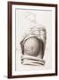 Cesarean Section, Incisions, Illustration, 1822-Science Source-Framed Giclee Print