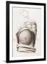 Cesarean Section, Incisions, Illustration, 1822-Science Source-Framed Giclee Print