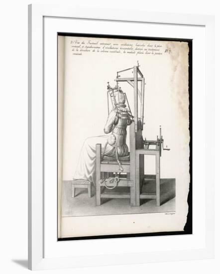 Chair Designed to Correct Deformities of the Spine Holding It in Any Desired Position-Langlume-Framed Art Print