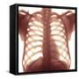 Chest X-ray of a Healhty Human Heart-Science Photo Library-Framed Stretched Canvas