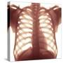 Chest X-ray of a Healhty Human Heart-Science Photo Library-Stretched Canvas