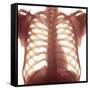Chest X-ray of a Healhty Human Heart-Science Photo Library-Framed Stretched Canvas