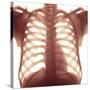 Chest X-ray of a Healhty Human Heart-Science Photo Library-Stretched Canvas