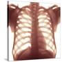 Chest X-ray of a Healhty Human Heart-Science Photo Library-Stretched Canvas