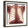 Chest X-ray of a Healhty Human Heart-Science Photo Library-Framed Premium Photographic Print