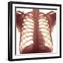 Chest X-ray of a Healhty Human Heart-Science Photo Library-Framed Premium Photographic Print