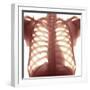 Chest X-ray of a Healhty Human Heart-Science Photo Library-Framed Premium Photographic Print