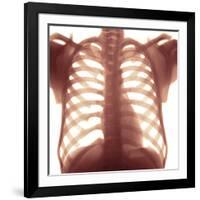 Chest X-ray of a Healhty Human Heart-Science Photo Library-Framed Photographic Print