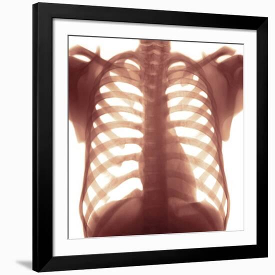 Chest X-ray of a Healhty Human Heart-Science Photo Library-Framed Photographic Print