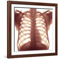 Chest X-ray of a Healhty Human Heart-Science Photo Library-Framed Photographic Print