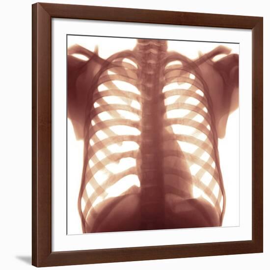 Chest X-ray of a Healhty Human Heart-Science Photo Library-Framed Photographic Print