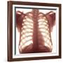 Chest X-ray of a Healhty Human Heart-Science Photo Library-Framed Photographic Print