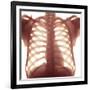 Chest X-ray of a Healhty Human Heart-Science Photo Library-Framed Photographic Print