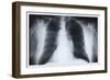 Chest-null-Framed Art Print