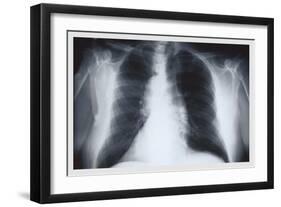 Chest-null-Framed Art Print