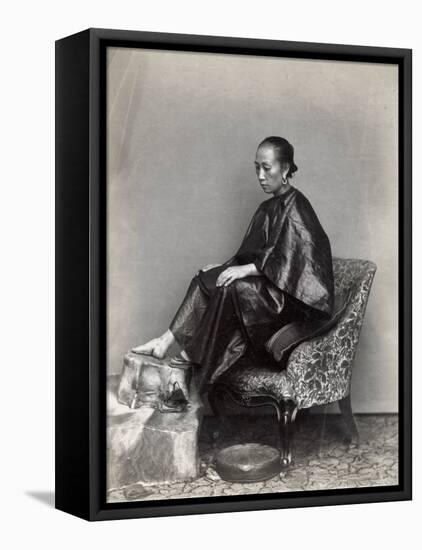 China, Woman with Small Bound Feet-null-Framed Stretched Canvas