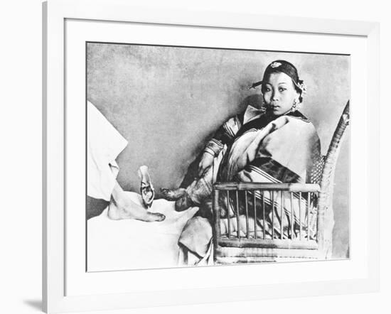 Chinese Woman Showing Her Uncovered Bound Foot Near an European Foot-John Thomson-Framed Giclee Print