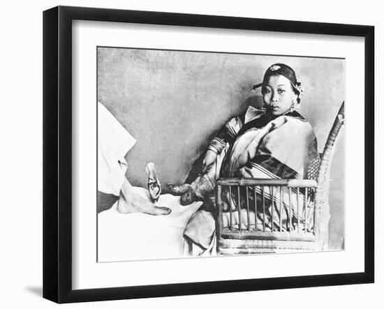 Chinese Woman Showing Her Uncovered Bound Foot Near an European Foot-John Thomson-Framed Giclee Print