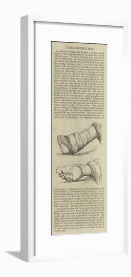 Chinese Women's Feet-null-Framed Giclee Print